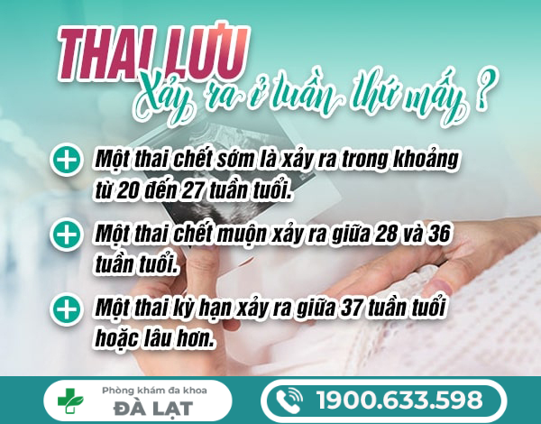 Hình ảnh minh họa